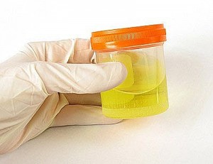 urine-drug-test