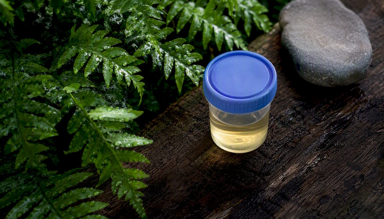 Urine sample cup with green leaves and natural elements