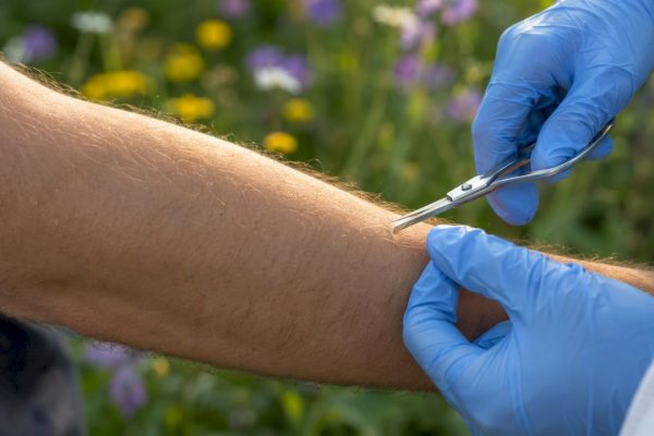 Scalp hair being cut for sample outdoors